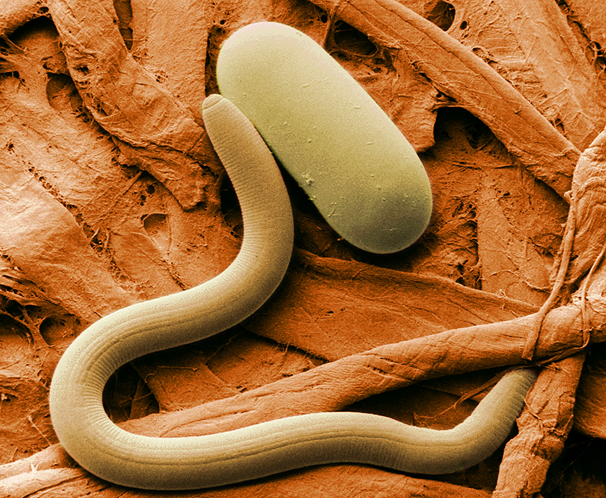 Soybean cyst nematode and egg (Photo courtesy of Wikipedia)