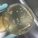 Growth of Metschnikowia reukaufii on agar plates (Photo by Leta Landucci)